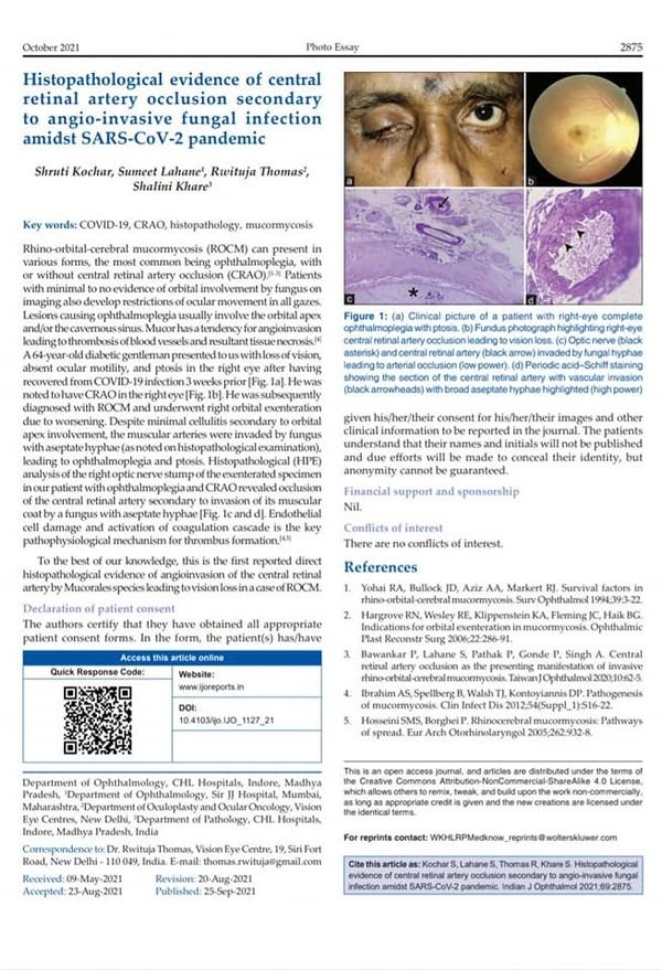 Journal publication by Dr. Shruti Kochar Maru